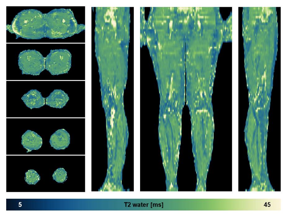 The water only T2 relaxation time of the lower extremity obtained from multi echo spin echo t2 mapping with EPG based reconstruction.